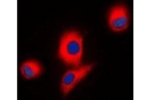 Immunofluorescent analysis of ICK staining in HEK293T cells. (ICK Antikörper)