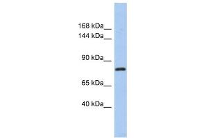 WB Suggested Anti-KLHL32 Antibody Titration: 0. (KLHL32 Antikörper  (Middle Region))