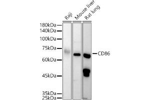 Western blot analysis of extracts of various cell lines, using CD86 antibody (ABIN3021700, ABIN3021701, ABIN3021702, ABIN1512724 and ABIN6215549) at 1:1000 dilution.