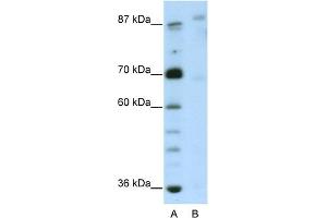 WB Suggested Anti-GLIS3 Antibody Titration:  2. (GLIS3 Antikörper  (N-Term))