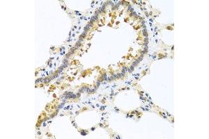 Immunohistochemistry of paraffin-embedded rat lung using CPA1 antibody. (CPA1 Antikörper)