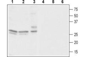 Western blot analysis of rat brain (lanes 1 and 4), mouse brain (lanes 2 and 5) and human neuroblastoma (SH-SY5Y) cells (lanes 3 and 6): - 1-3. (CACNG3 Antikörper  (C-Term, Intracellular))