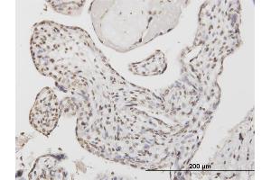 Immunoperoxidase of monoclonal antibody to ATF1 on formalin-fixed paraffin-embedded human placenta.