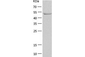 CDR2 Protein (AA 1-454) (His tag)