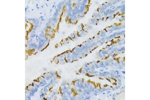 Immunohistochemistry of paraffin-embedded mouse lung using PTGER2 Antibody (ABIN5971508) at dilution of 1/100 (40x lens). (PTGER2 Antikörper)