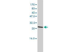 Western Blotting (WB) image for anti-Clathrin, Light Chain B (CLTB) (AA 1-211) antibody (ABIN560415)