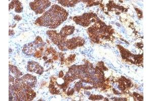 Formalin-fixed, paraffin-embedded human parathyroid stained with PTH antibody (PTH/1175). (PTH Antikörper  (AA 32-115))