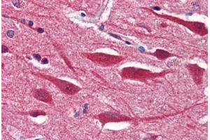 anti-Syntaxin 2 (STX2) (AA 1-19) antibody