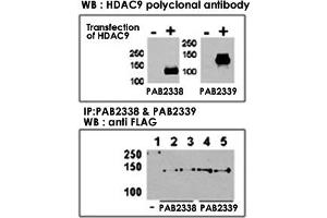 Both anti-HDAC9 N-term  and C-term  polyclonal antibody were tested by WB and IP-WB using HeLa and HeLa-HDAC9 transfected cells. (HDAC9 Antikörper  (C-Term))