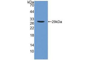 Western blot analysis of recombinant Human iPLA2. (PNPLA2 Antikörper  (AA 484-701))