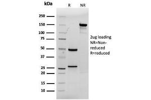 SDS-PAGE Analysis Purified CDX2 Mouse Monoclonal Antibody (rCDX2/1690). (Rekombinanter CDX2 Antikörper  (AA 150-249))