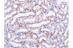 Paraformaldehyde-fixed, paraffin embedded mouse kidney tissue, Antigen retrieval by boiling in sodium citrate buffer(pH6) for 15min, Block endogenous peroxidase by 3% hydrogen peroxide for 30 minutes, Blocking buffer (normal goat serum) at 37°C for 20min, Antibody incubation with MCSF Receptor Polyclonal Antibody, Unconjugated  at 1:500 overnight at 4°C, followed by a conjugated secondary and DAB staining (CSF1R Antikörper  (AA 201-300))