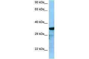 WB Suggested Anti-RGS4 Antibody Titration: 1. (RGS4 Antikörper  (C-Term))