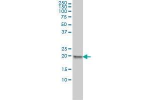 MPHOSPH6 monoclonal antibody (M01), clone 1D8-2A8 Western Blot analysis of MPHOSPH6 expression in HeLa . (MPHOSPH6 Antikörper  (AA 1-160))