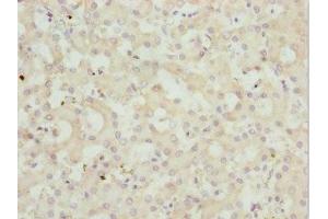 Immunohistochemistry of paraffin-embedded human liver tissue using ABIN7162962 at dilution of 1:100 (PEX3 Antikörper  (AA 144-373))