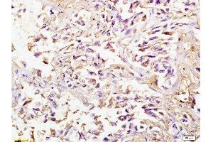 Immunohistochemistry (Paraffin-embedded Sections) (IHC (p)) image for anti-Secreted Protein, Acidic, Cysteine-Rich (Osteonectin) (SPARC) (AA 101-200) antibody (ABIN738141)
