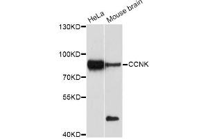 Western blot analysis of extracts of various cell lines, using CCNK Antibody (ABIN5997384) at 1/1000 dilution. (Cyclin K Antikörper)