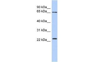WB Suggested Anti-ZNF428 Antibody Titration: 0. (ZNF428 Antikörper  (N-Term))