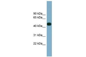 WB Suggested Anti-ABHD12 Antibody Titration:  0.