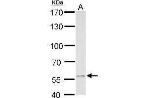 Western Blotting (WB) image for anti-Malonyl CoA Decarboxylase (MLYCD) antibody (ABIN2856728)