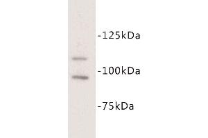 Western Blotting (WB) image for anti-Mast/stem Cell Growth Factor Receptor (KIT) antibody (ABIN1854841) (KIT Antikörper)