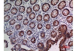 Immunohistochemistry (IHC) analysis of paraffin-embedded Human Colon, antibody was diluted at 1:100.