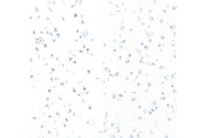 Immunocytochemistry (ICC) image for anti-Replication Protein A2, 32kDa (RPA2) (pSer4), (pSer8) antibody (ABIN7453379) (Rekombinanter RPA2 Antikörper  (pSer4, pSer8))