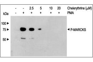 Cells were incubated with different concentrations of Chelerythrine chloride (ABIN7885754) for 30 min and then stimulated with PMA (ABIN7885941), (3 ng/mL) for 20 min. (Chelerythrine chloride)