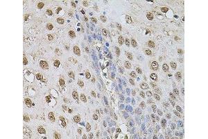 Immunohistochemistry of paraffin-embedded Human esophagus using Cyclin A2 Polyclonal Antibody at dilution of 1:100 (40x lens). (Cyclin A Antikörper)
