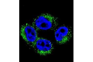Confocal immunofluorescent analysis of M1 Antibody (Center) 2036c with  cell followed by Alexa Fluor 488-conjugated goat anti-rabbit lgG (green). (AP1M1 Antikörper  (AA 199-227))