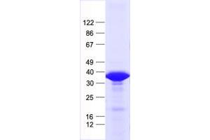Western Blotting (WB) image for Potassium Channel Tetramerisation Domain Containing 13 (KCTD13) protein (His tag) (ABIN2712306)