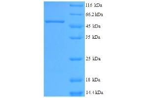 Gastric Intrinsic Factor (Vitamin B Synthesis) (GIF) (AA 19-417) protein (His tag) expressed in E.