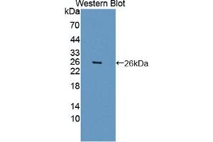 Western blot analysis of the recombinant protein. (ARNTL Antikörper  (AA 1-169))
