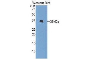 Western Blotting (WB) image for anti-Insulin (INS) (AA 88-108) antibody (ABIN1859457) (Insulin Antikörper  (AA 88-108))