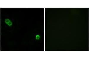 Immunofluorescence analysis of MCF7 cells, using PHCA Antibody. (ACER3 Antikörper  (AA 171-220))