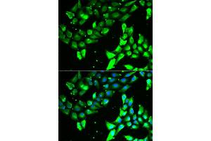 Immunofluorescence analysis of A549 cell using KIF2B antibody. (KIF2B Antikörper)