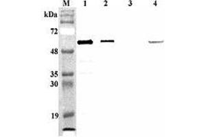 Western blot analysis of mouse FTO using anti-FTO (mouse), pAb  at 1:4,000 dilution. (FTO Antikörper)