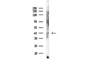 anti-Fructose-1,6-Bisphosphatase 1 (FBP1) (Internal Region) antibody