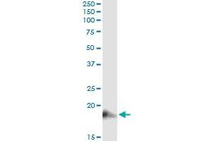 BST2 (Human) IP-WB Antibody Pair