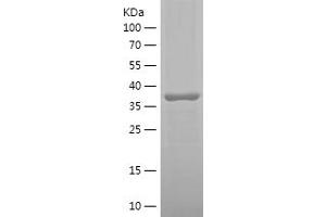 STT3A Protein (AA 475-634) (His-IF2DI Tag)