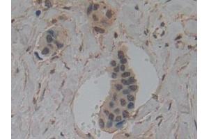 Immunohistochemistry (IHC) image for anti-Gelsolin (GSN) (AA 577-771) antibody (ABIN7442030)