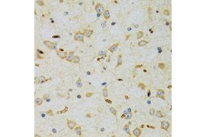 Immunohistochemistry of paraffin-embedded rat brain using SRP19 antibody (ABIN2560139) at dilution of 1:100 (40x lens). (SRP19 Antikörper)