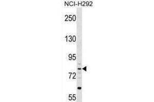 Western Blotting (WB) image for anti-Cartilage Acidic Protein 1 (CRTAC1) antibody (ABIN2999928) (CRTAC1 Antikörper)