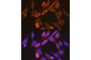 Immunofluorescence analysis of NIH-3T3 cells using  Rabbit mAb (ABIN7265412) at dilution of 1:100 (40x lens). (ACVRL1 Antikörper)