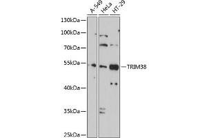 Western blot analysis of extracts of various cell lines, using TRIM38 antibody (ABIN1683145, ABIN3016312, ABIN3016313 and ABIN6219714) at 1:1000 dilution. (TRIM38 Antikörper  (AA 266-465))
