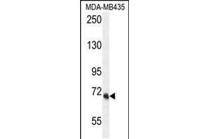 Western blot analysis in MDA-MB435 cell line lysates (35ug/lane). (VPS52 Antikörper  (C-Term))