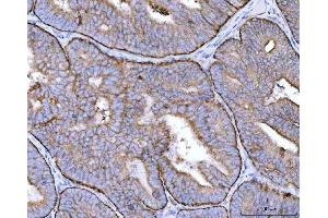IHC analysis of MRPS22 using anti-MRPS22 antibody (ABIN7600613). (MRPS22 Antikörper  (AA 21-329))