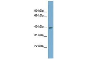 Image no. 1 for anti-Aspartate beta-Hydroxylase Domain Containing 2 (ASPHD2) (AA 107-156) antibody (ABIN6744195) (ASPHD2 Antikörper  (AA 107-156))