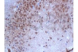 Formalin-fixed and paraffin embedded rat brain tissue with labeled Anti-Phospho-Estrogen Receptor alpha (Ser167) Polyclonal Antibody, Unconjugated (ABIN729493) at 1:200, followed by conjugation to the secondary antibody and DAB staining (Estrogen Receptor alpha Antikörper  (pSer167))