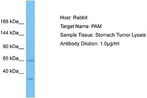 Host: Rabbit Target Name: PAM Sample Type: Stomach Tumor lysates Antibody Dilution: 1.